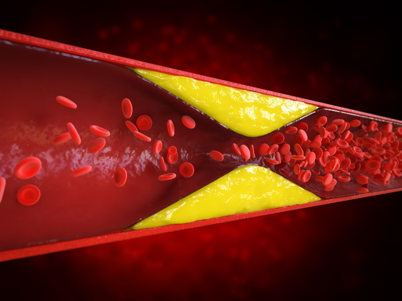 [Giải Đáp] Uống Omega-3 Giảm Cholesterol Không?